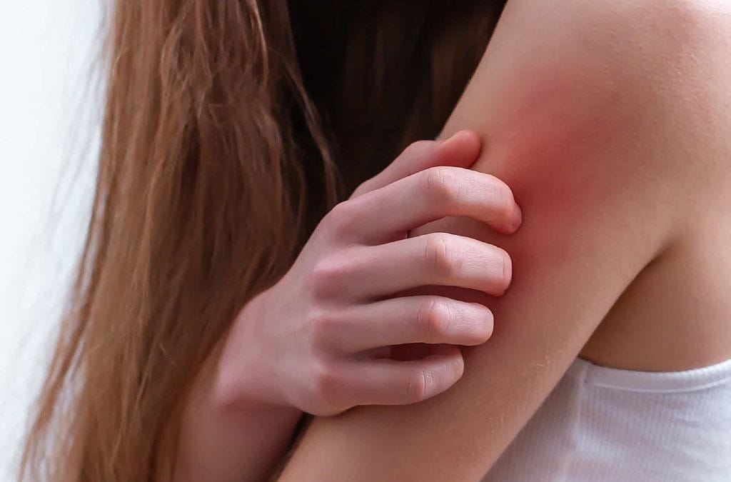 Bewährte Hausmittel gegen Heuschnupfen